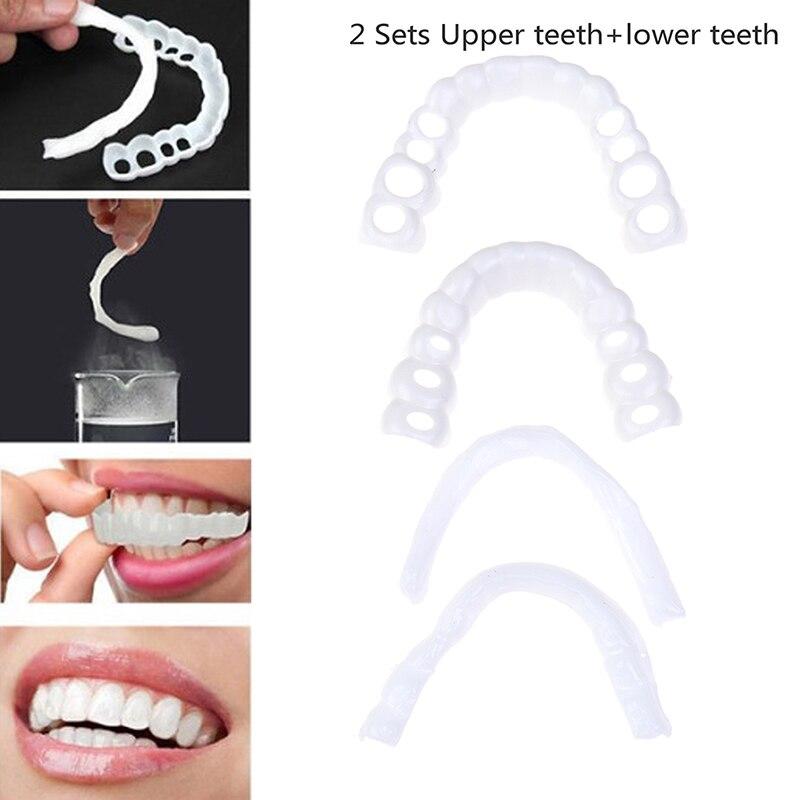 Kit de Prótese Dental Superior e Inferior – Smile Pro – Dentes Brancos Sem Cirurgia
